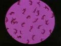 The Attack of Devil Germ
